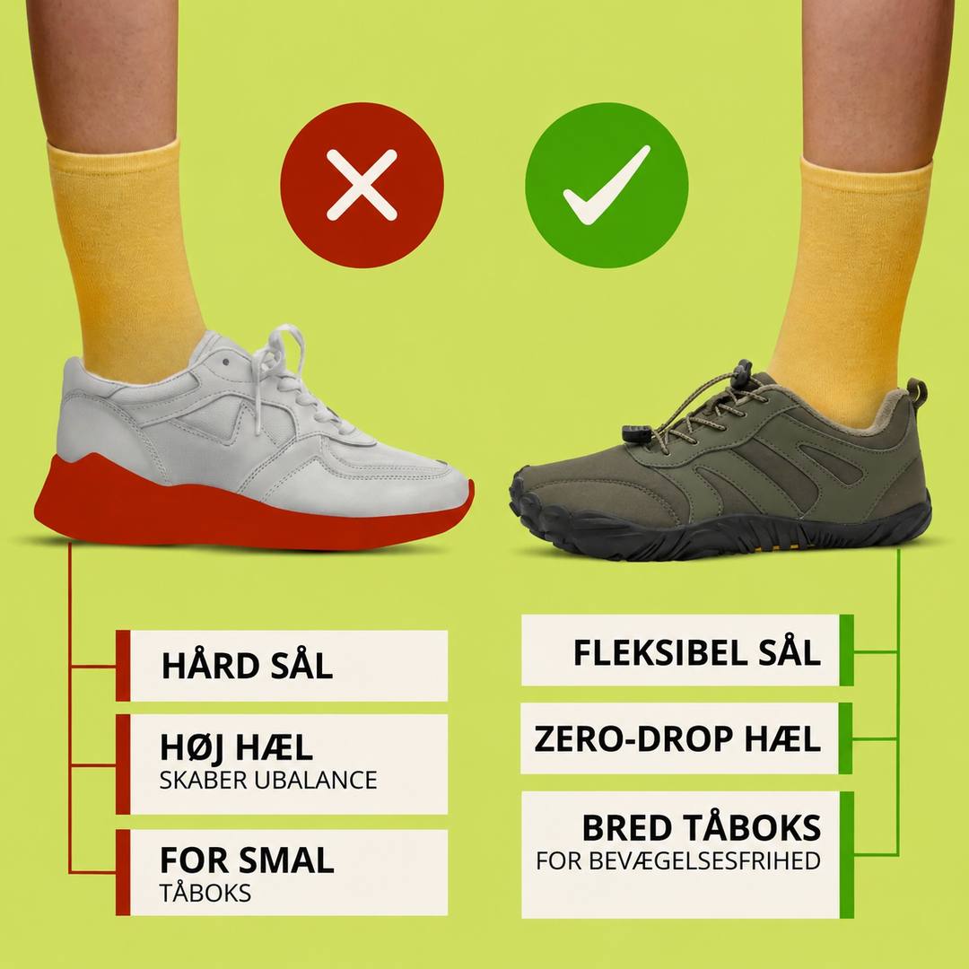 SÆRPRÆGET